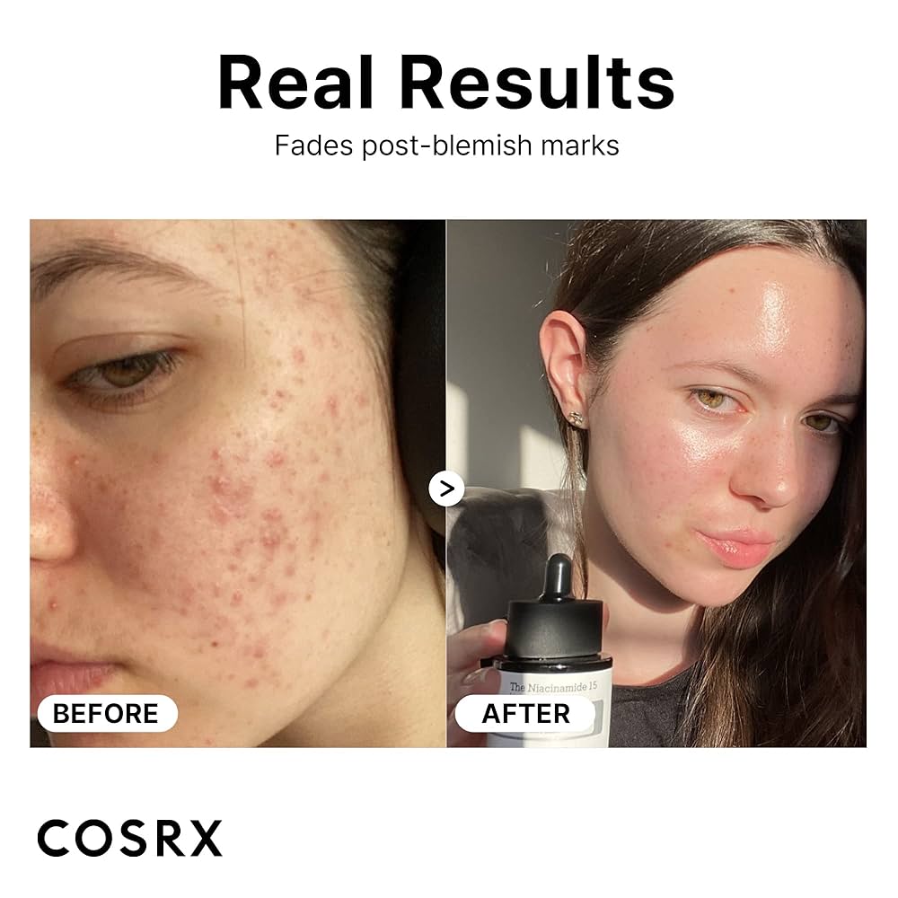 COSRX - The Niacinamide 15 Serum 20ml